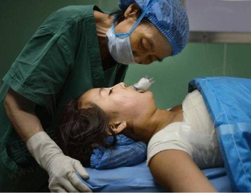 三、患者分享：栾杰医生自体脂肪隆胸体验