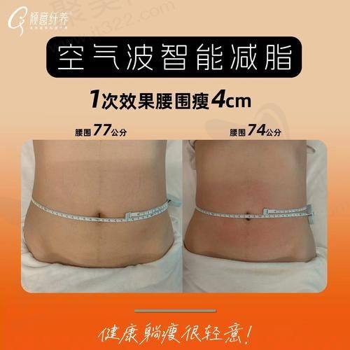 洛阳孔繁荣医疗美容腰腹部环吸的作用和成效明显