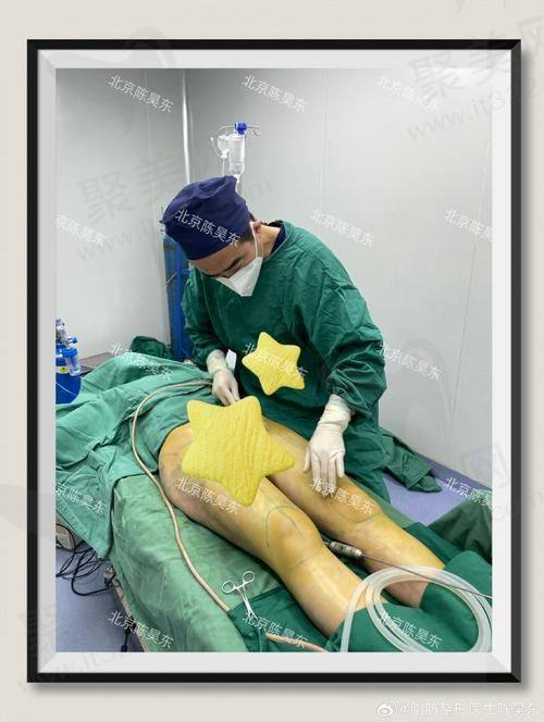 洛阳孔繁荣医疗美容其他项目收费标准参考
