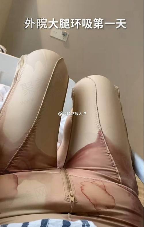 成都八大处整形唐勇院长面诊：专精又贴心
