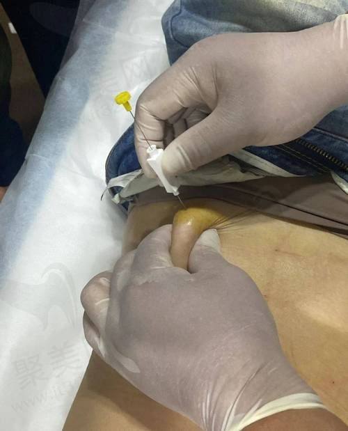 南宁芭芘丽医疗美容整体正规可靠性