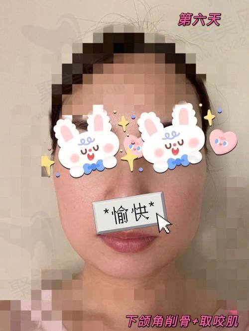 李继华医生是何背景出身？
