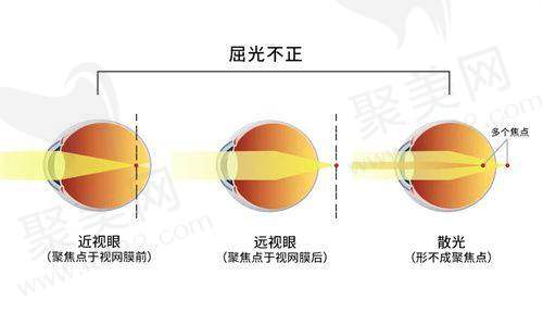 烟台华厦康爱眼科医院是公立的吗？私立性质但有正规资质还享医保报销服务