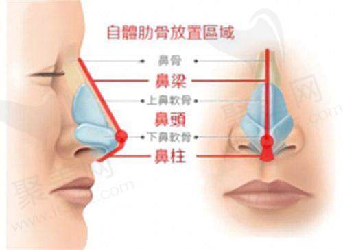 成都玉之光整形医院的优势在哪？