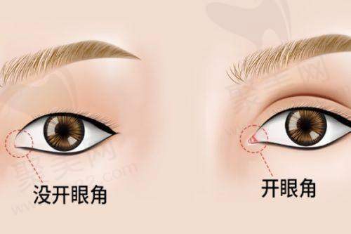 重庆艺星整形医院与华美整形医院对比分析，哪个更值得选择？详细评测与真实反馈全面解析！