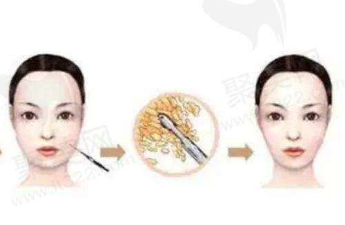 丰富多样的医美项目
