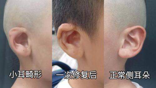 湖州市中 心医院整形美容科其他项目及综合评价