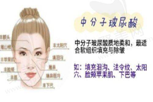 擅长项目