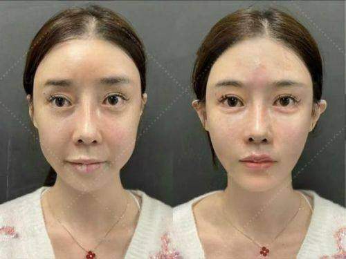 5 a级实力彰显靠谱