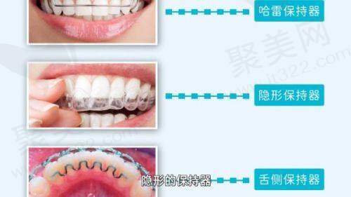 五、厦门登特口腔的收费情况