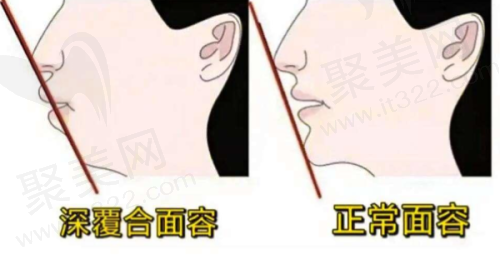 四、重庆齿齿美口腔牙齿修复类项目价格及成效