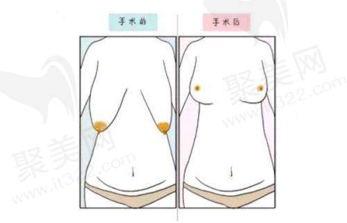 热门医美项目