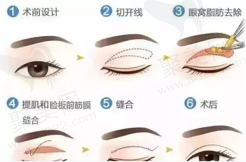 选择整形医院的要点