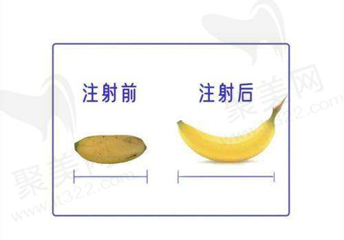 3、汉中韩美整形医院——老牌正规整形医院