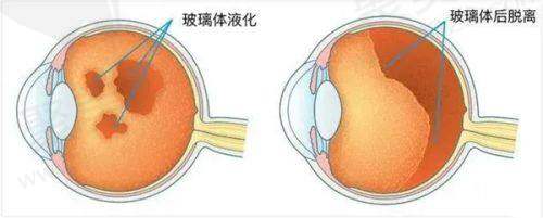 深圳普瑞眼科斜视弱视视功能训练体验套餐技术水平