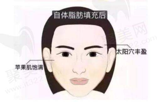 南宁芭芘丽医疗技术怎么样？优质服务提升就医体验
