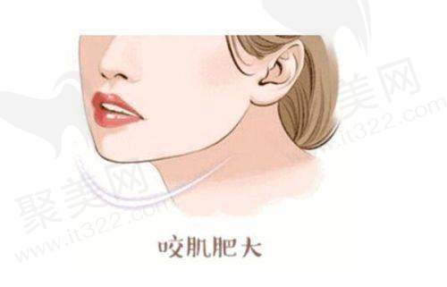 杭州时光与维多利亚哪个好？技术优势、医院口碑与预约攻略全解析