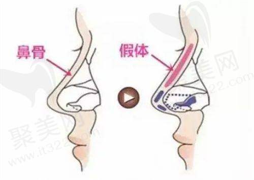 重庆艺星整形美容医院地址在哪里？具体位置位于重庆市渝北区红锦大道16号，交通非常便捷