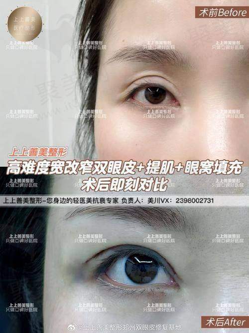 四、郑州杨丽美颜医疗美容的价格与口碑