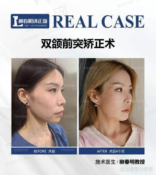 五、同行对柳春明医生的评价