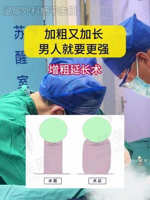 海绵体注射有什么作用能维持的多久？主要治疗勃起功能障碍