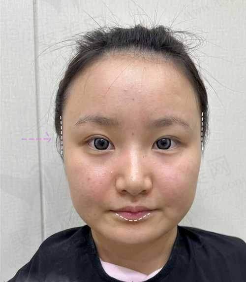 9. 长沙协雅医疗美容医院 - 为每位患者定制方案