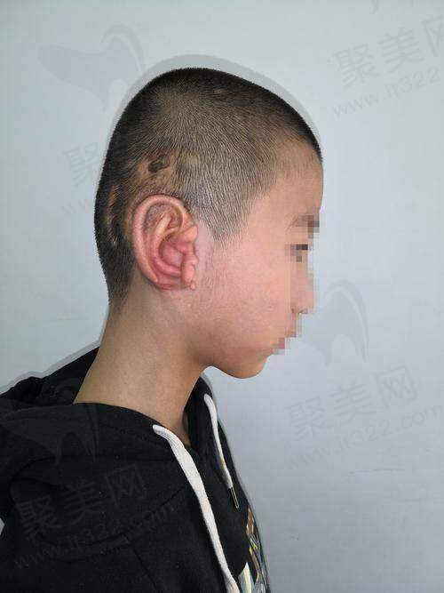 总结