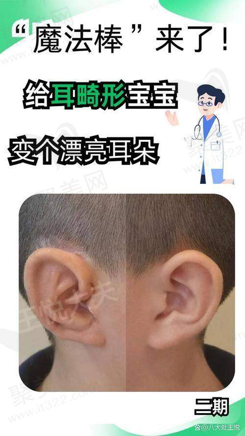 三、东莞人造耳朵手术收费情况