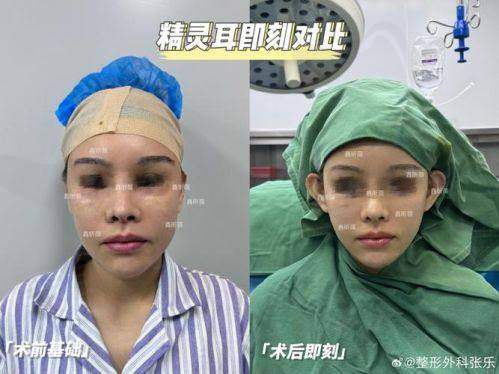 一、长沙耳朵整形好的正规医院排名