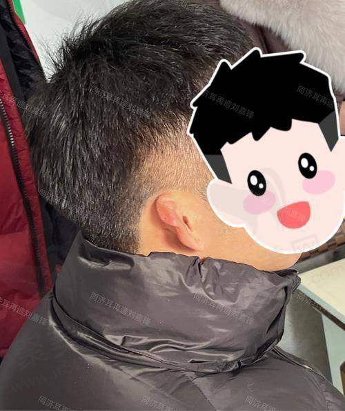4. 东莞市虎门医院整形外科 - 专精儿童耳畸形治疗