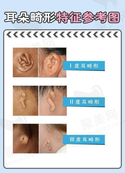 2. 广东医 科 大学附属东莞第一医院 - 综合实力强劲