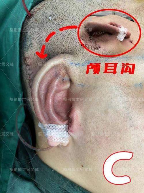 二、长沙耳朵整形好的正规医院详细介绍