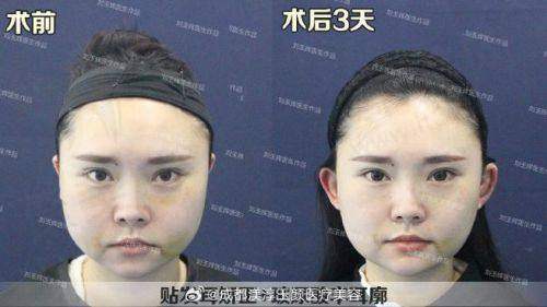一、成都耳朵整形医院前十名单