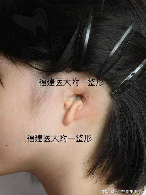 6. 杭州第一人民医院美容整形科