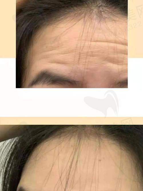 五、美学设计建议及注意事项