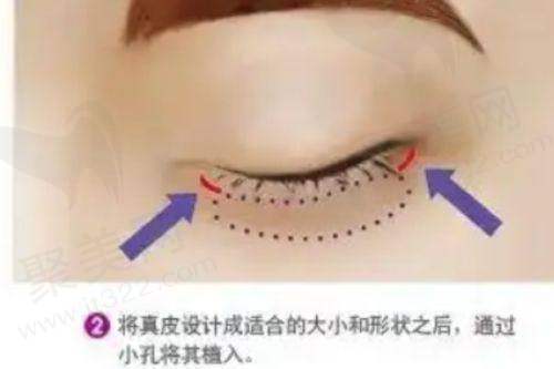 想知道杭州彭涛医生在哪坐诊？吸脂技术好价格亲民，附预约方式
