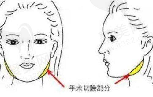 总结