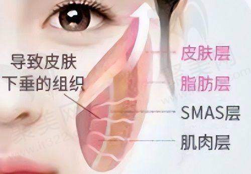 北京面部提升排名前三医院揭晓！黄寺、加减美、蒂凡妮技术价格大比拼！