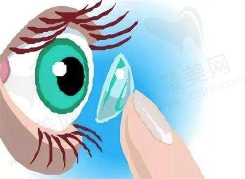 嘉兴爱尔眼科医院全飞秒做得好吗？亲测从纠结到摘镜体验清晰生活超便利！