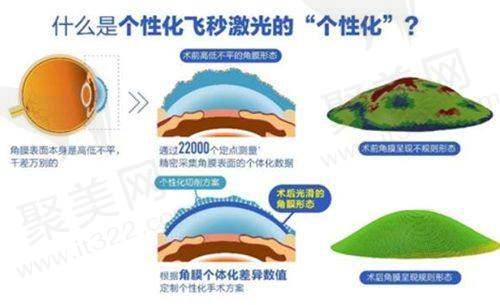 眼科相关项目价格参考