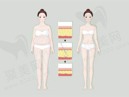 二、山东滨州曦朵医疗美容