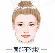 重庆艺星朱星蓉注射乔雅登雅致玻尿酸的实际实例