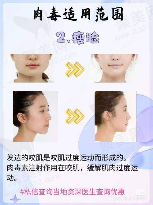 2025合肥整形医院Top10名单及名医推荐来了！找华美赵辑、韩美罗安定等不踩雷！