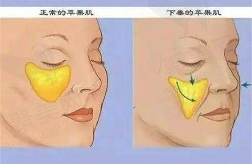 重庆艺星朱家旭自体脂肪面部填充6930元起的服务项目概述