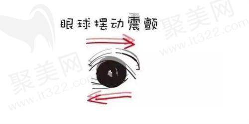 悦瞳眼科：综合眼科服务的贴心体验
