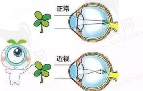 嘉兴爱尔眼科医院全飞秒做得好吗？总结评价