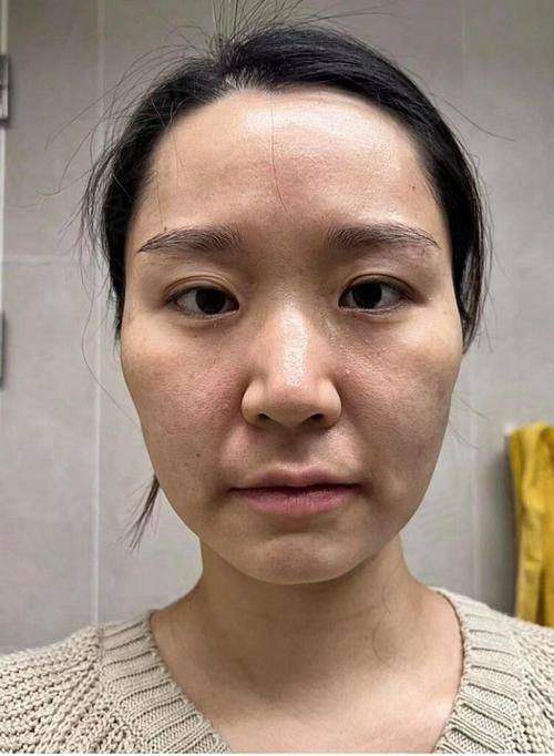 总结