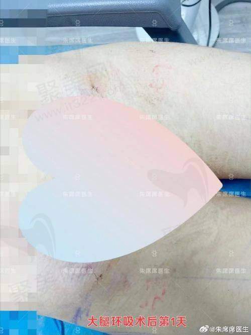 七、王恒医生真实的患者评价