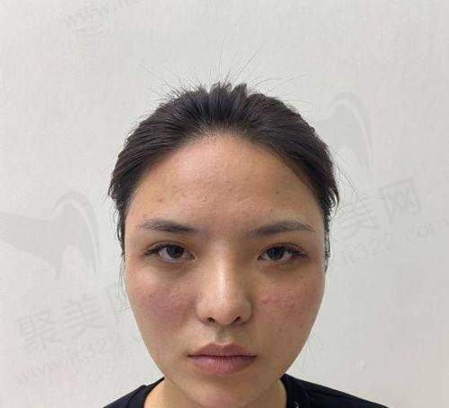 重庆艺星注射濡白天使的技术特点