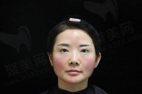 重庆艺星朱星蓉注射濡白天使技术揭秘，价格2880元起，能够有效改善皮肤的光泽度、紧致度和整体美观